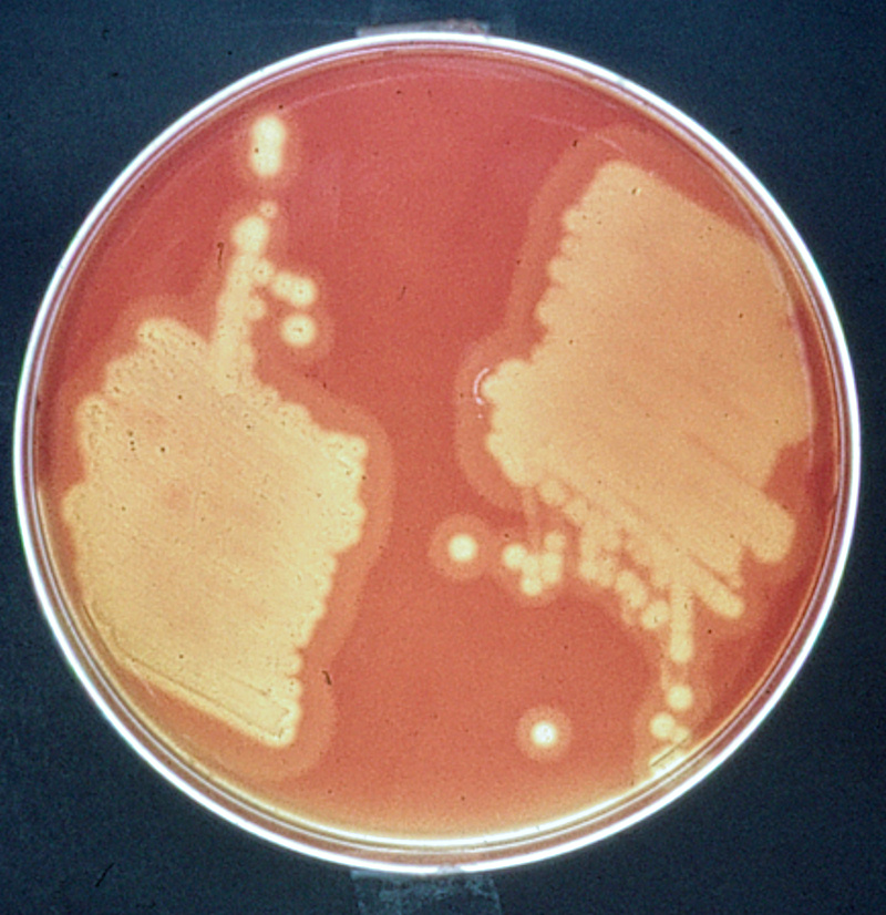 culture bactéries levures